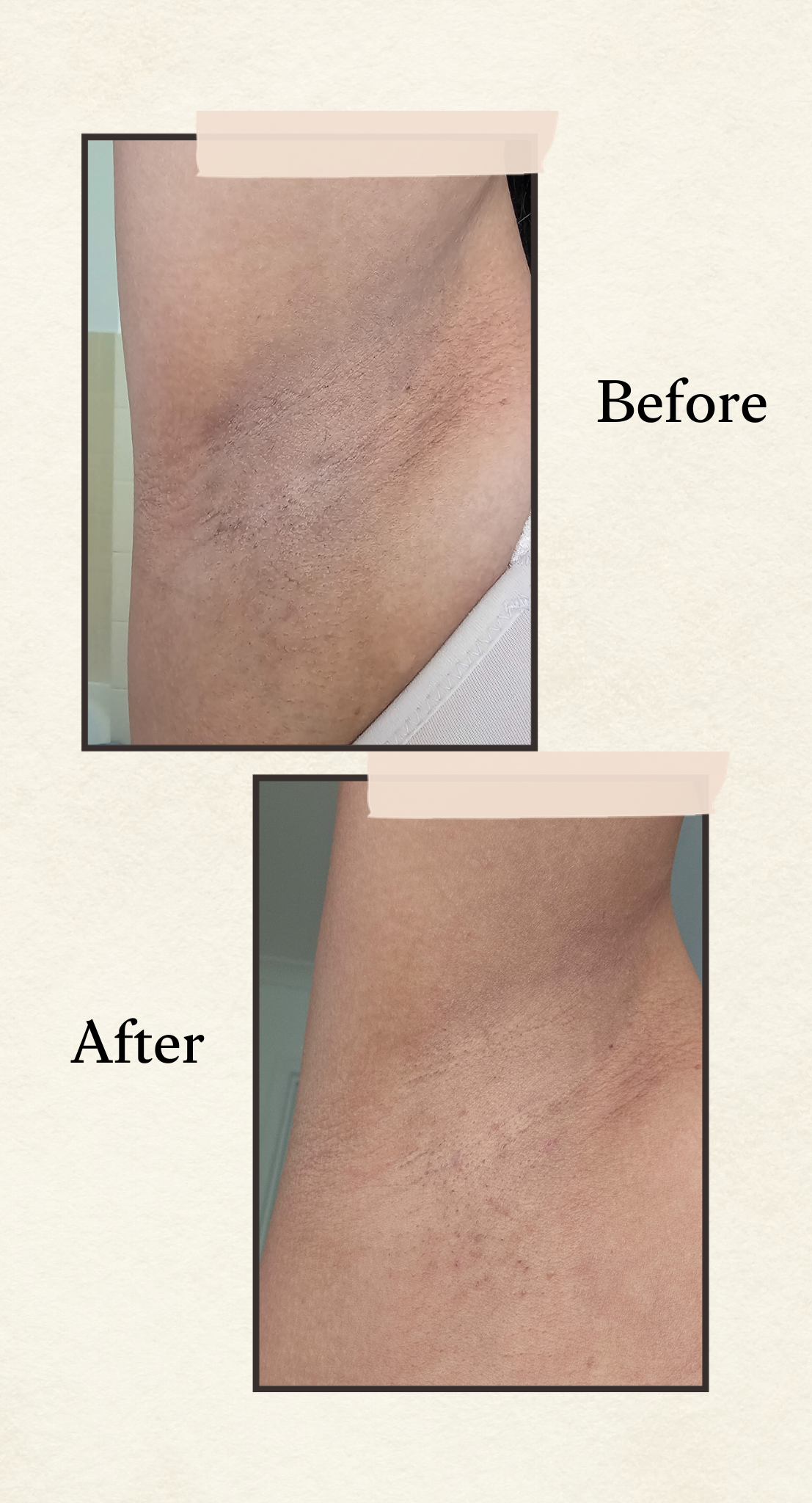 Before and after comparison showing brightening results on skin, with the top labeled 'Before' and the bottom labeled 'After' on a light beige background.